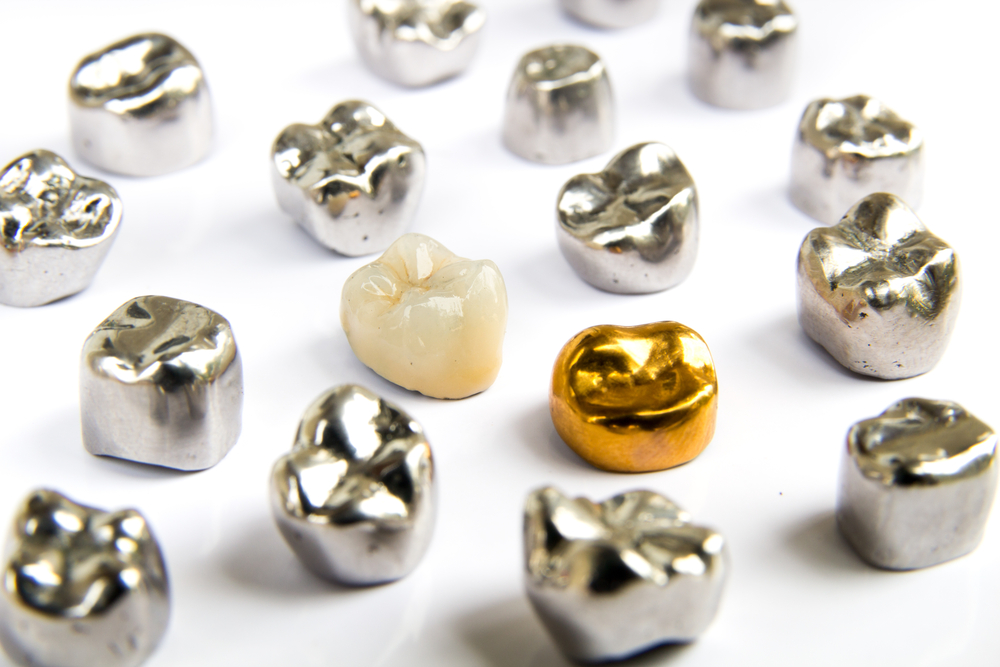 Dental,Ceramic,,Gold,And,Metal,Tooth,Crowns,On,White,Background.
