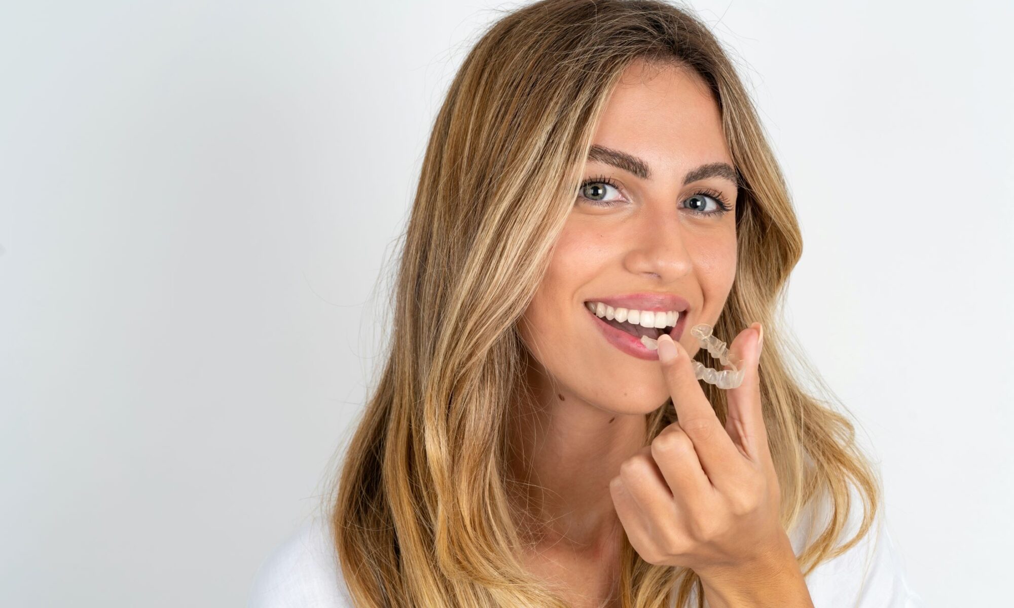 Invisalign